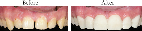 North Corona dental images
