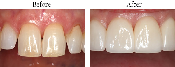 dental images 11368